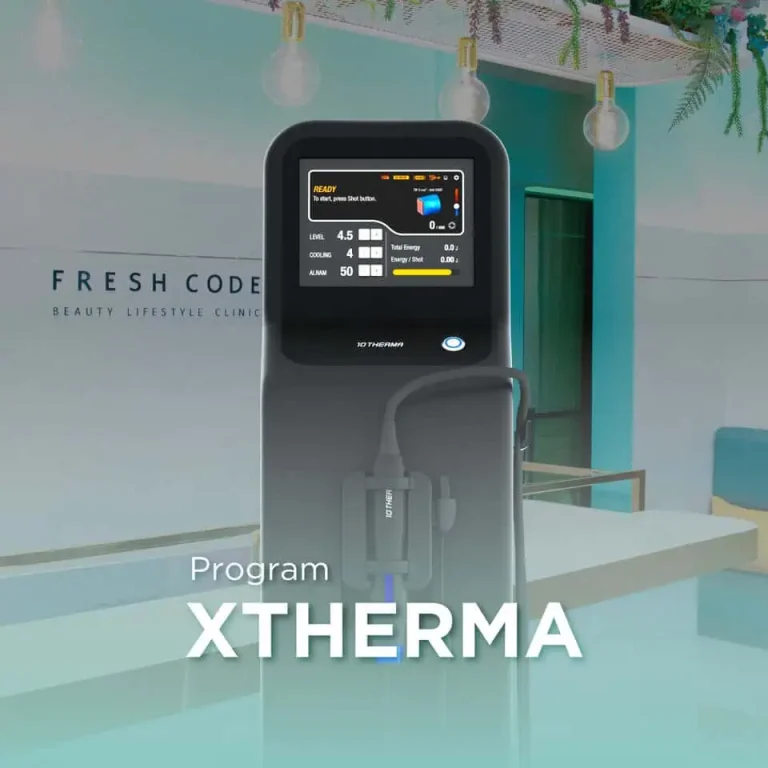 XTherma is a skin tightening device using Monopolar RF technology, administered by expert physicians at Fresh Code Clinic, for lifting and firming the facial contours, reducing sagging, and stimulating collagen production.
