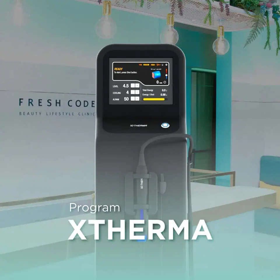 XTherma is a skin tightening device using Monopolar RF technology, administered by expert physicians at Fresh Code Clinic, for lifting and firming the facial contours, reducing sagging, and stimulating collagen production.