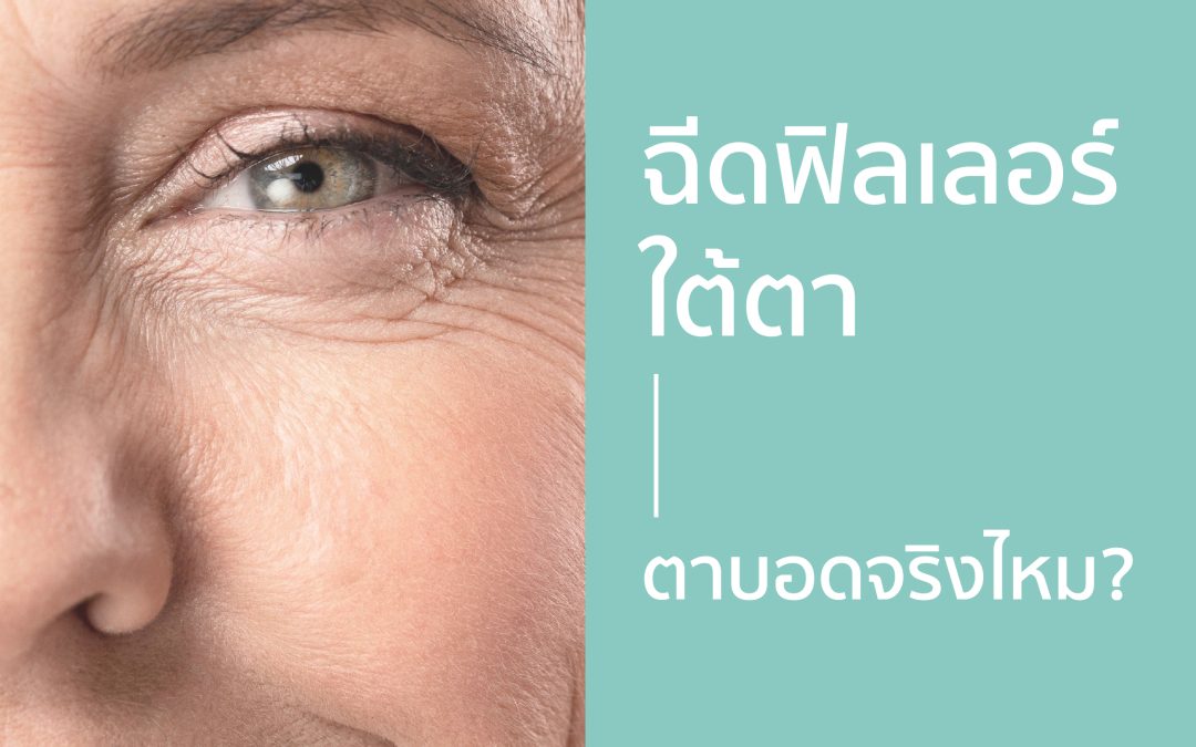 ฉีดฟิลเลอร์ใต้ตา ตาบอดจริงไหม?