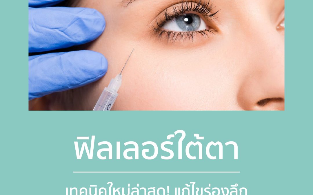 ฟิลเลอร์ใต้ตา: เทคนิคใหม่ล่าสุด! แก้ไขร่องลึก ถุงใต้ตาให้หน้าเด็กลง โดยไม่ต้องผ่าตัด