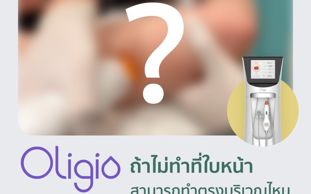 Oligio ถ้าไม่ทำที่ใบหน้า สามารถทำตรงบริเวณไหนได้อีกบ้าง?