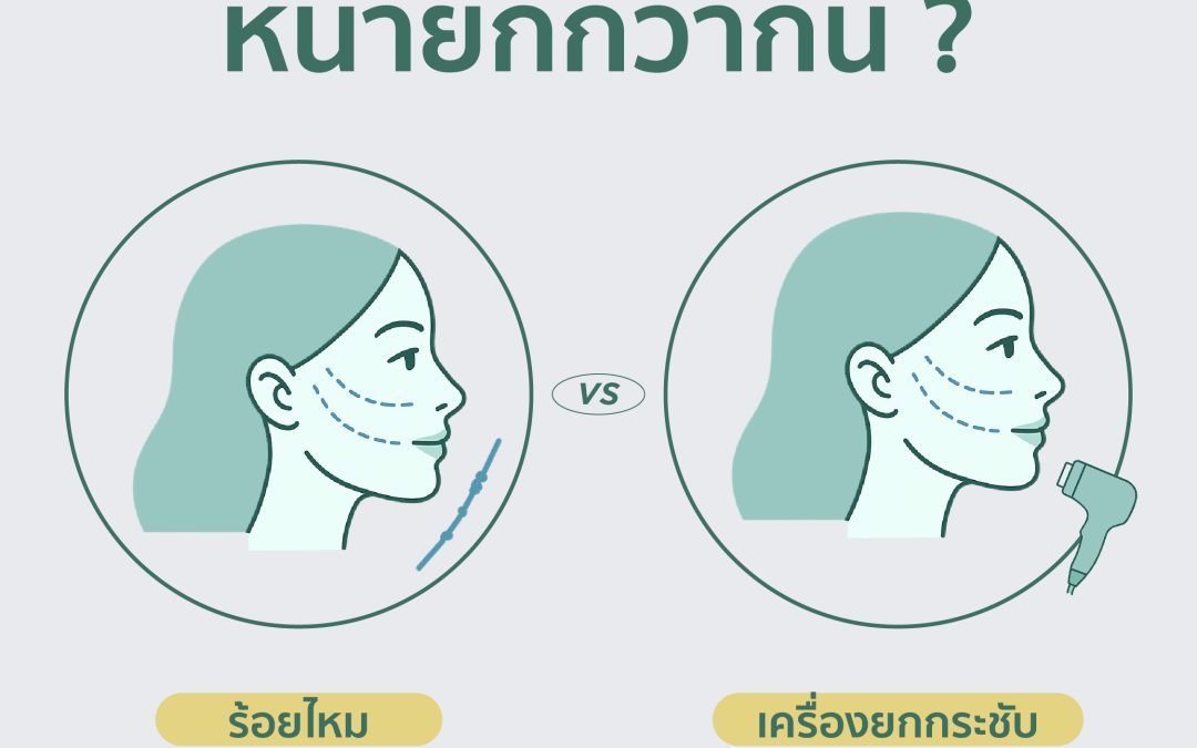 ร้อยไหมกับเครื่องยกกระชับ อันไหนหน้ายกกว่ากัน ?