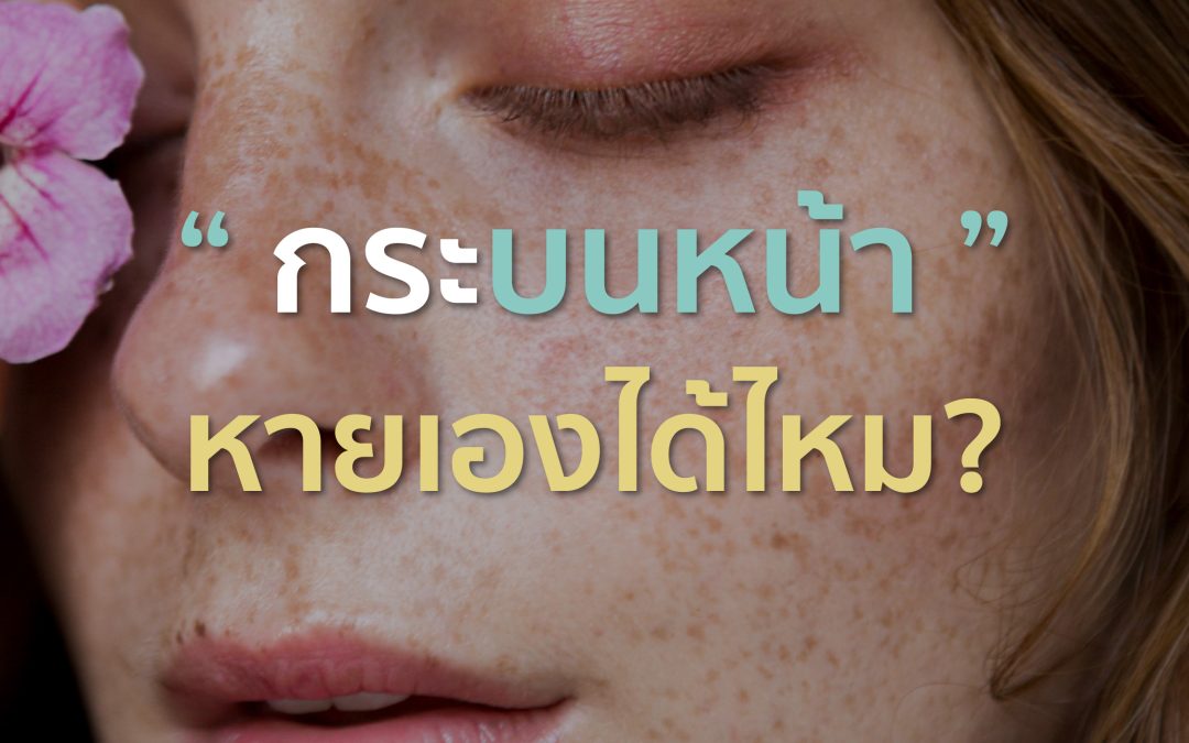 กระบนใบหน้าสามารถทาครีมหรือหายเองไหม? 🌤️