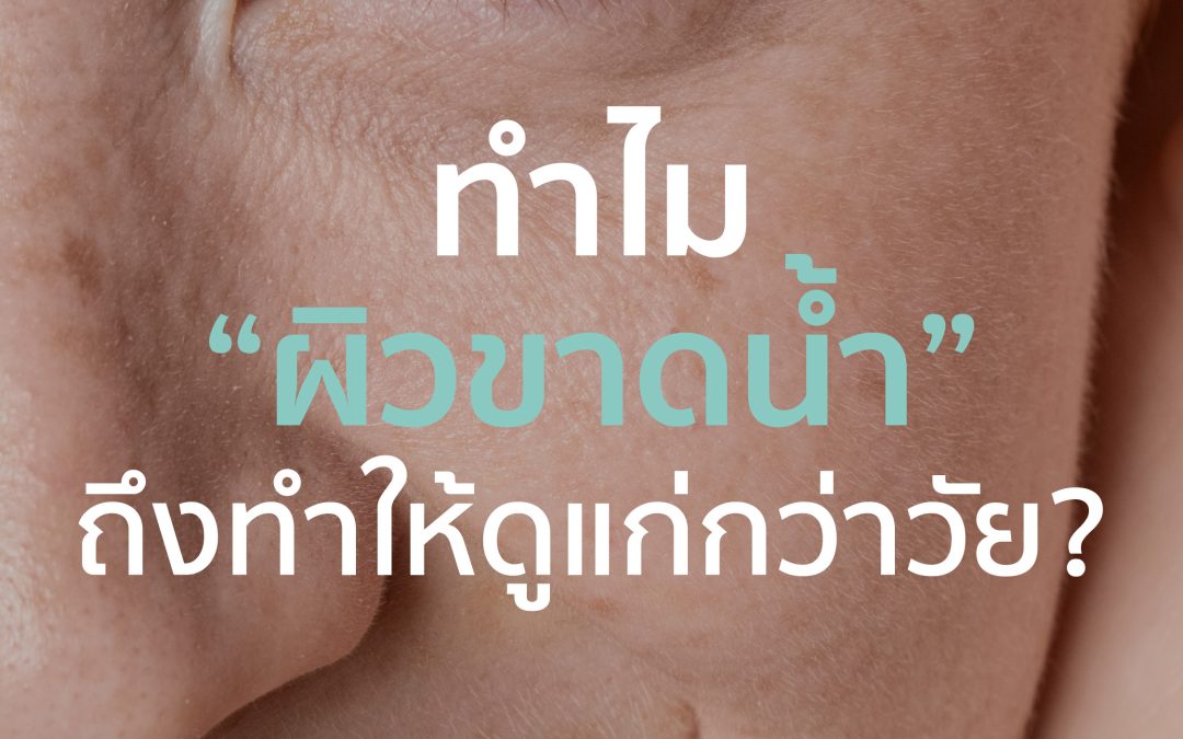 ทำไม “ผิวขาดน้ำ” ถึงทำให้ดูแก่กว่าวัย 💦