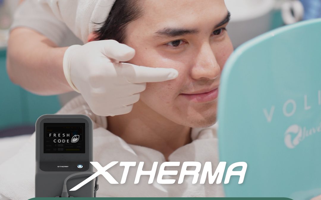 XTherma อยู่ได้นานแค่ไหน?