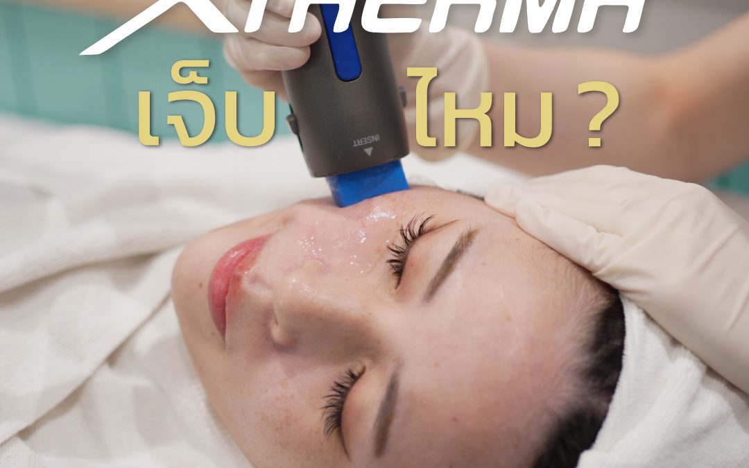 XTherma เจ็บไหม?