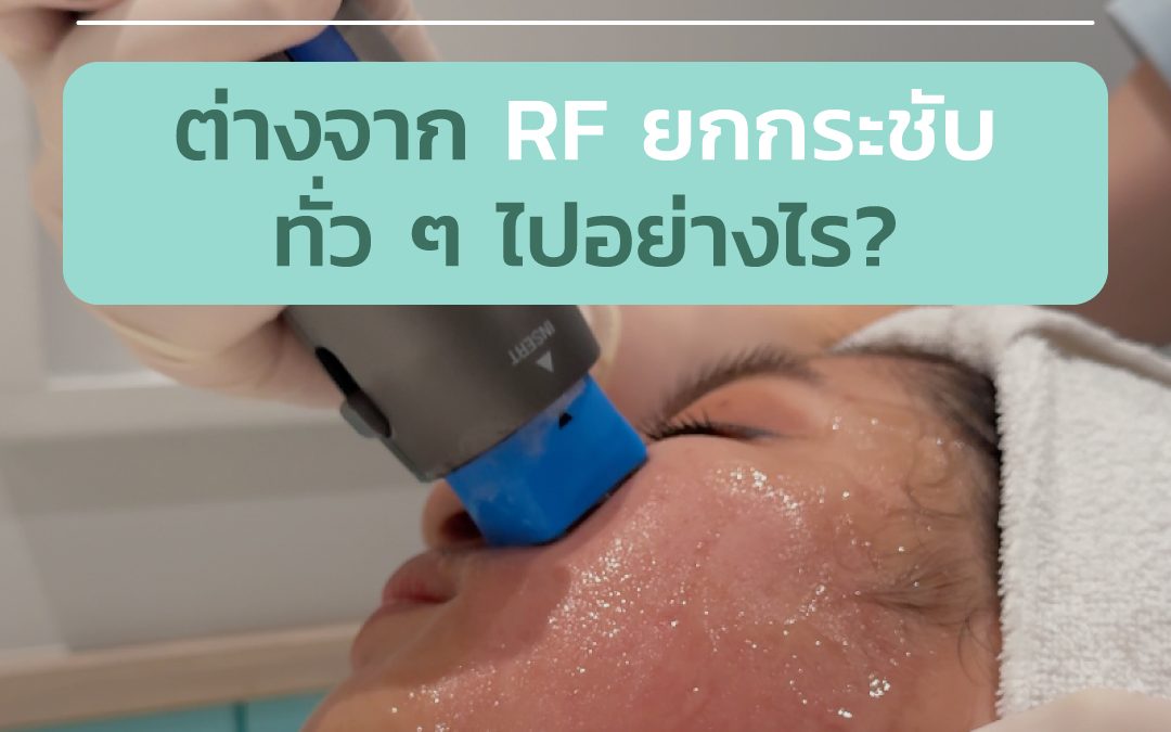 XTherma คืออะไร และต่างจาก RF ยกกระชับทั่ว ๆ ไปอย่างไร?
