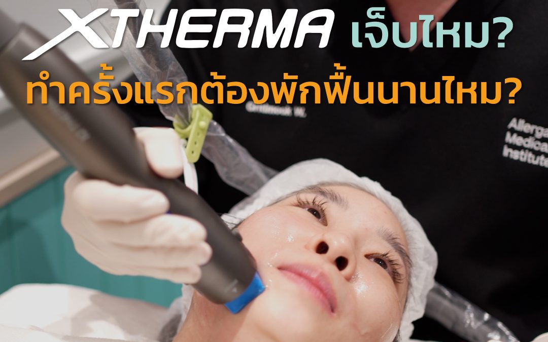 🧊 XTherma เจ็บไหม? ทำครั้งแรกต้องพักฟื้นนานไหม?