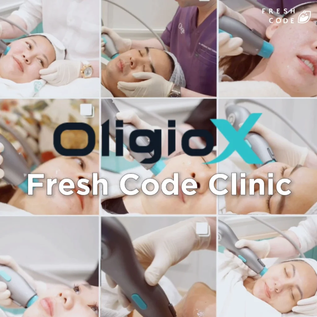 ขั้นตอนการทำ Oligio X ที่ Fresh Code Clinic