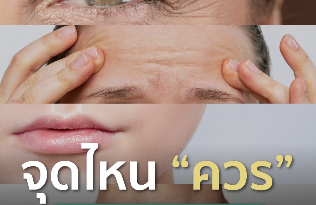 จุดไหนควรและไม่ควรฉีด Botox