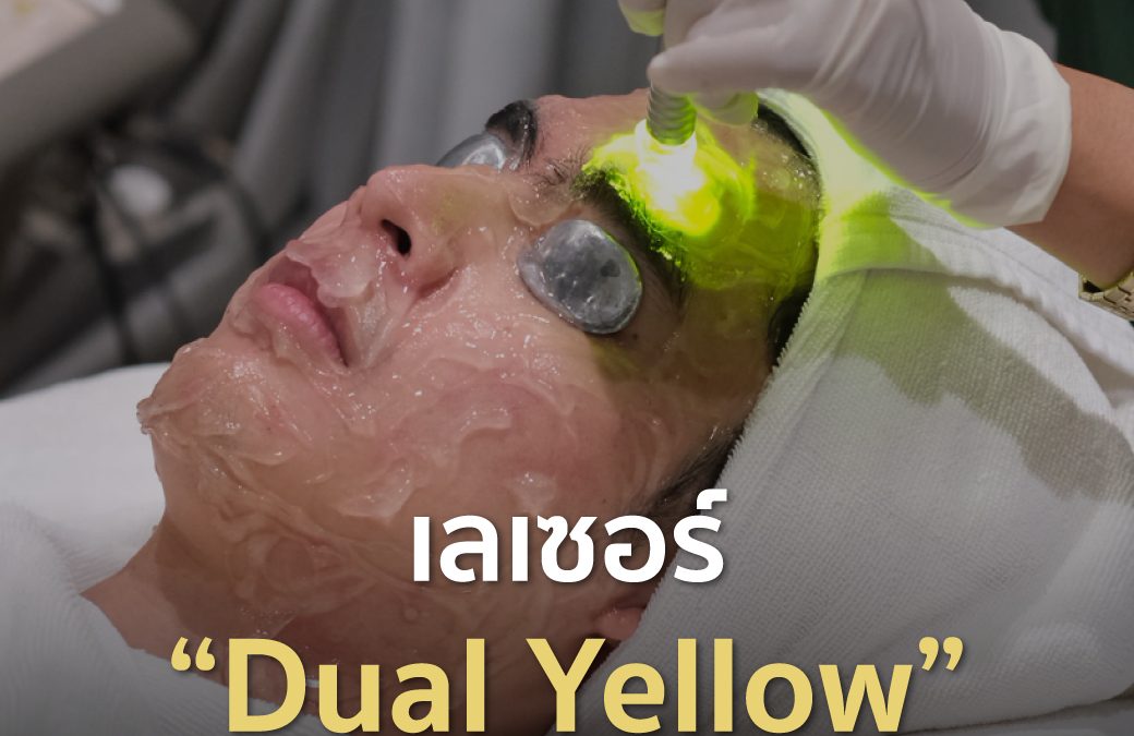 เลเซอร์ Dual Yellow ช่วยลดรอยแดงสิวได้จริงไหม?