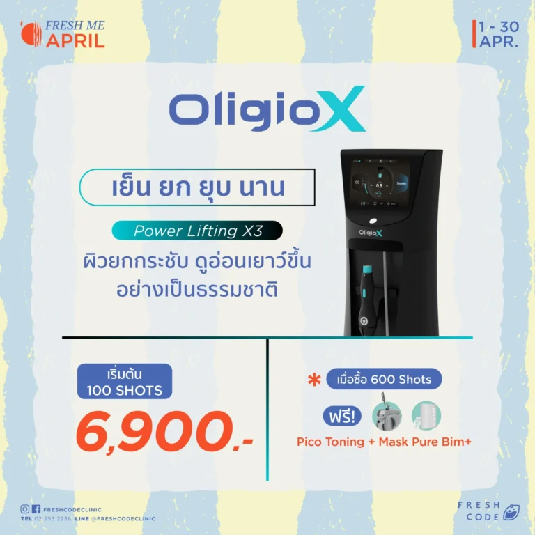 โปรโมชั่น Oligio X เทคโนโลยี RF ยกกระชับผิว กระตุ้นคอลลาเจน และปรับผิวให้เรียบเนียน โดยคลินิกความงามในกรุงเทพ