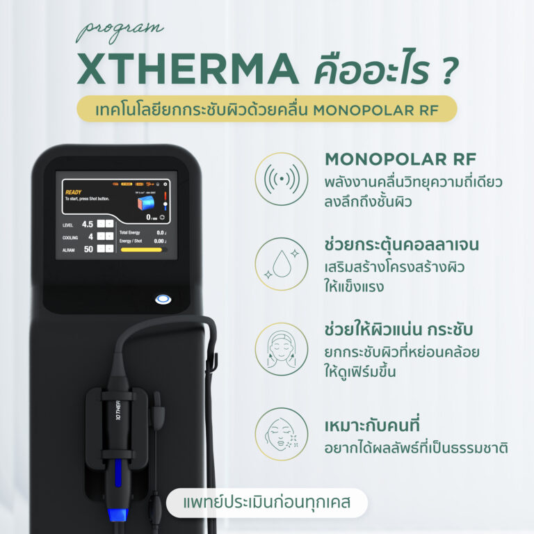 Xtherma คืออะไร