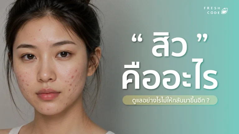 สิวคืออะไร
