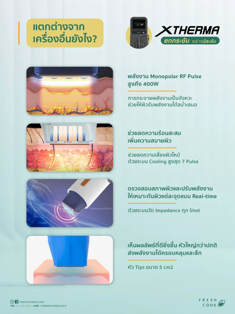 หลักการทำงาน Xtherma