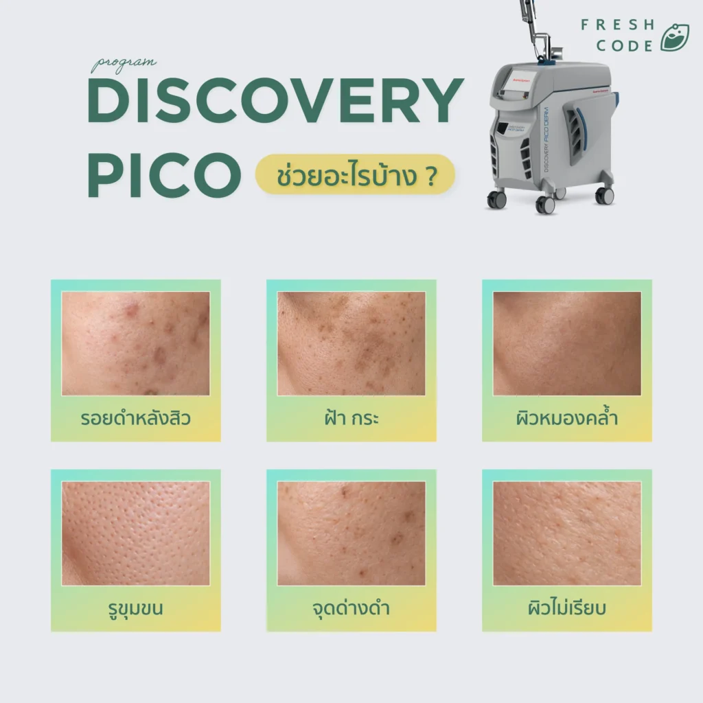 Discovery Pico ช่วยเรื่องอะไรบ้าง ?