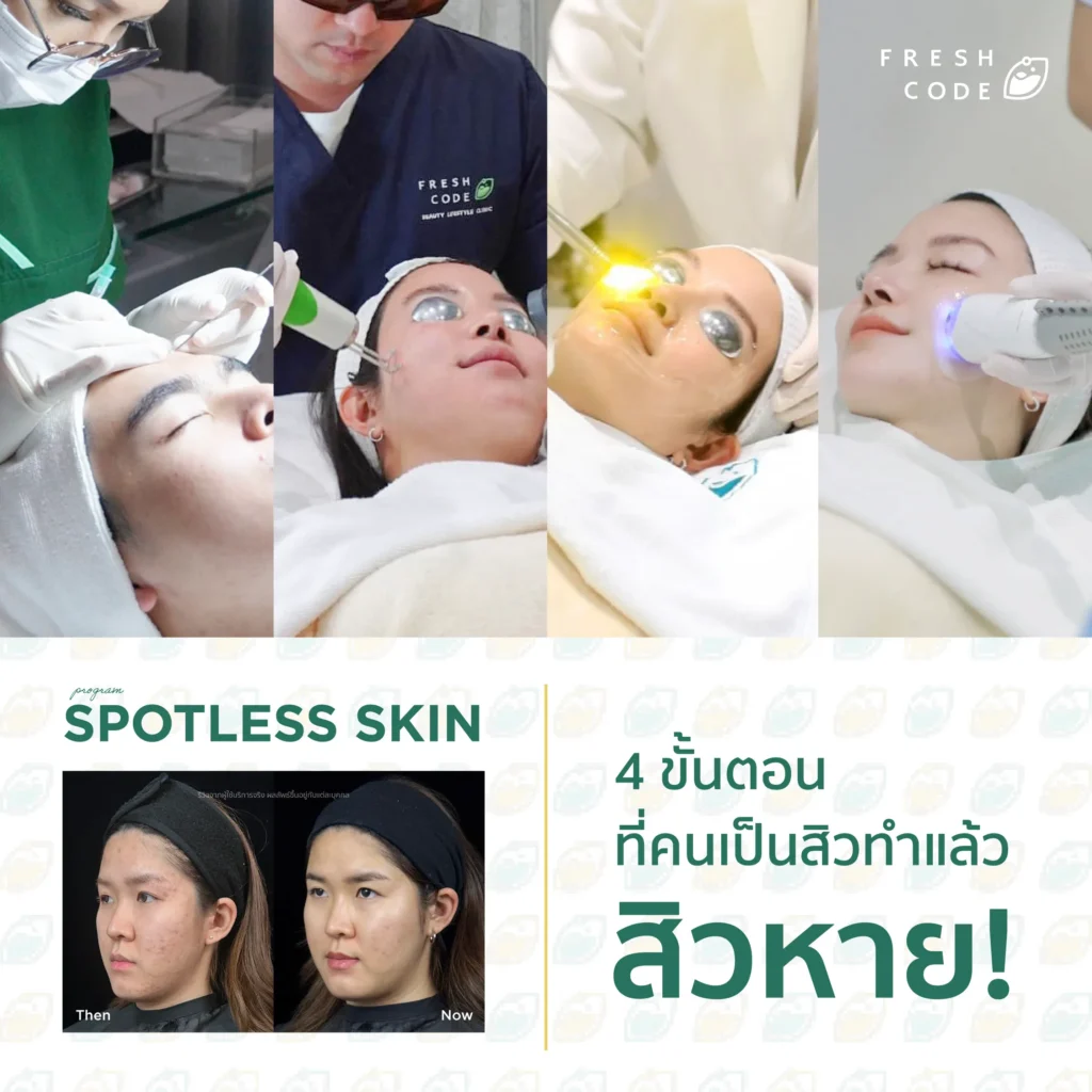 เจาะลึก 4 ขั้นตอนกู้ผิวพังในโปรแกรม Spotless Skin