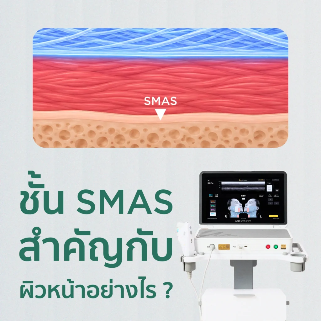 ชั้น Smas