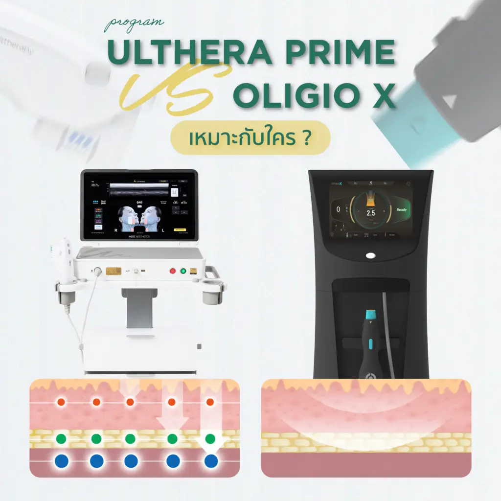 Ulthera Prime กับ Oligio X เหมาะกับใคร