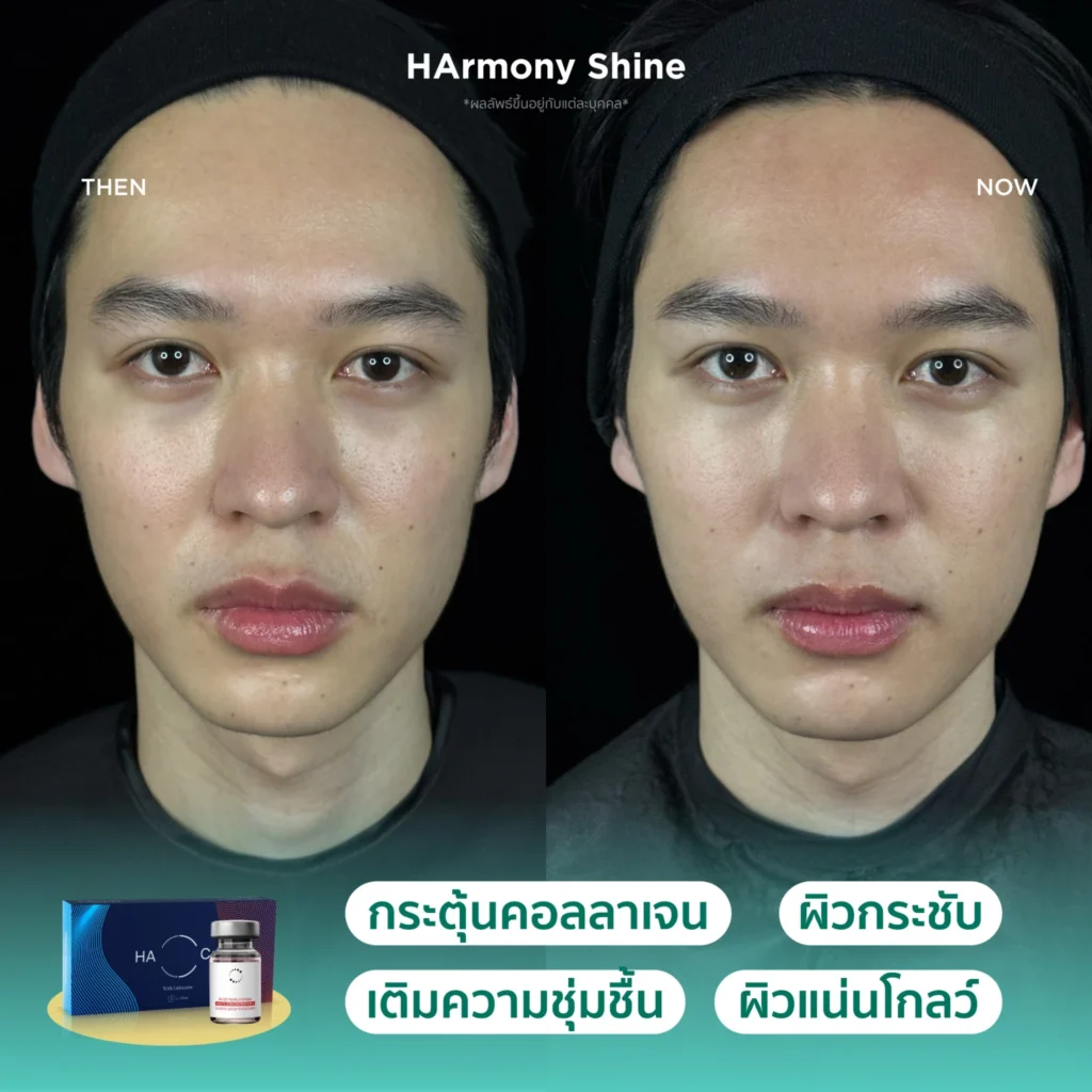 รีวิวโปรแกรม HArmony Shine เป็น HArmonyCa กับ NCTF