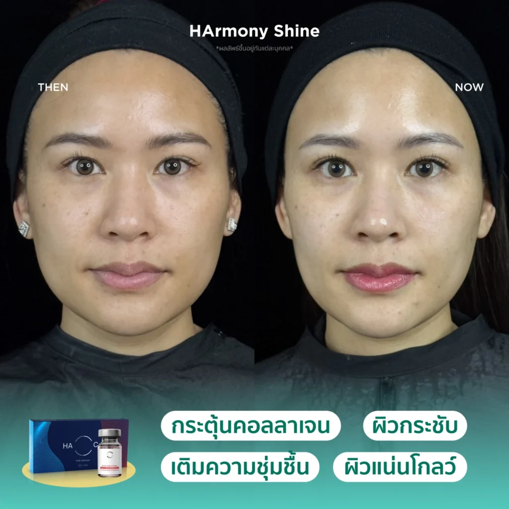 รีวิวโปรแกรม HArmony Shine เป็น HArmonyCa กับ NCTF-1