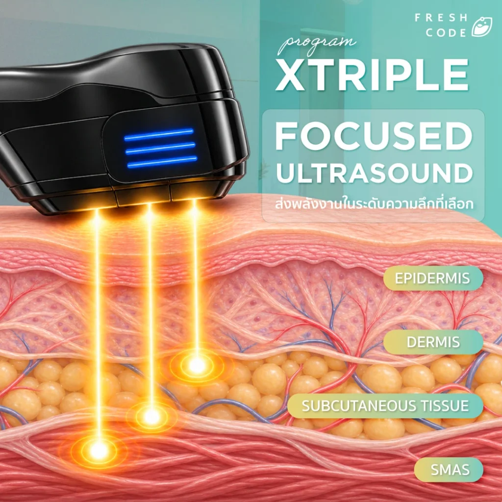 หลักการทำงานของ XTriple HIFU ในชั้นผิวและเนื้อเยื่อ