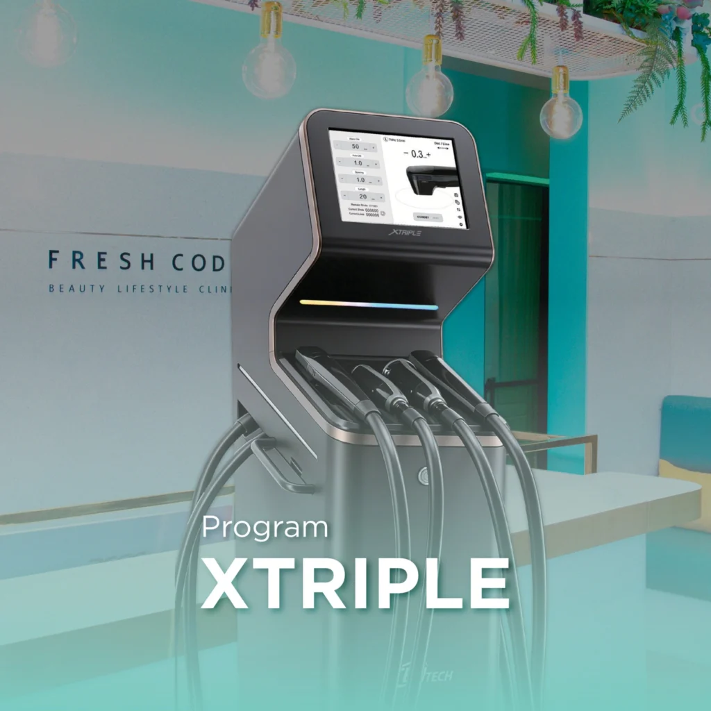 XTriple เครื่องยกกระชับด้วย 3-Line HIFU ที่ Fresh Code Clinic สุขุมวิท 5