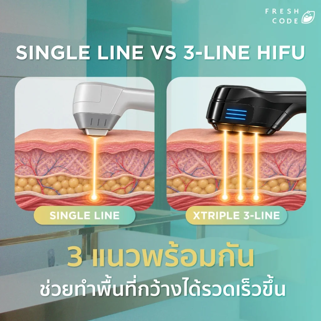 เปรียบเทียบ Single Line HIFU กับ XTriple 3-Line HIFU